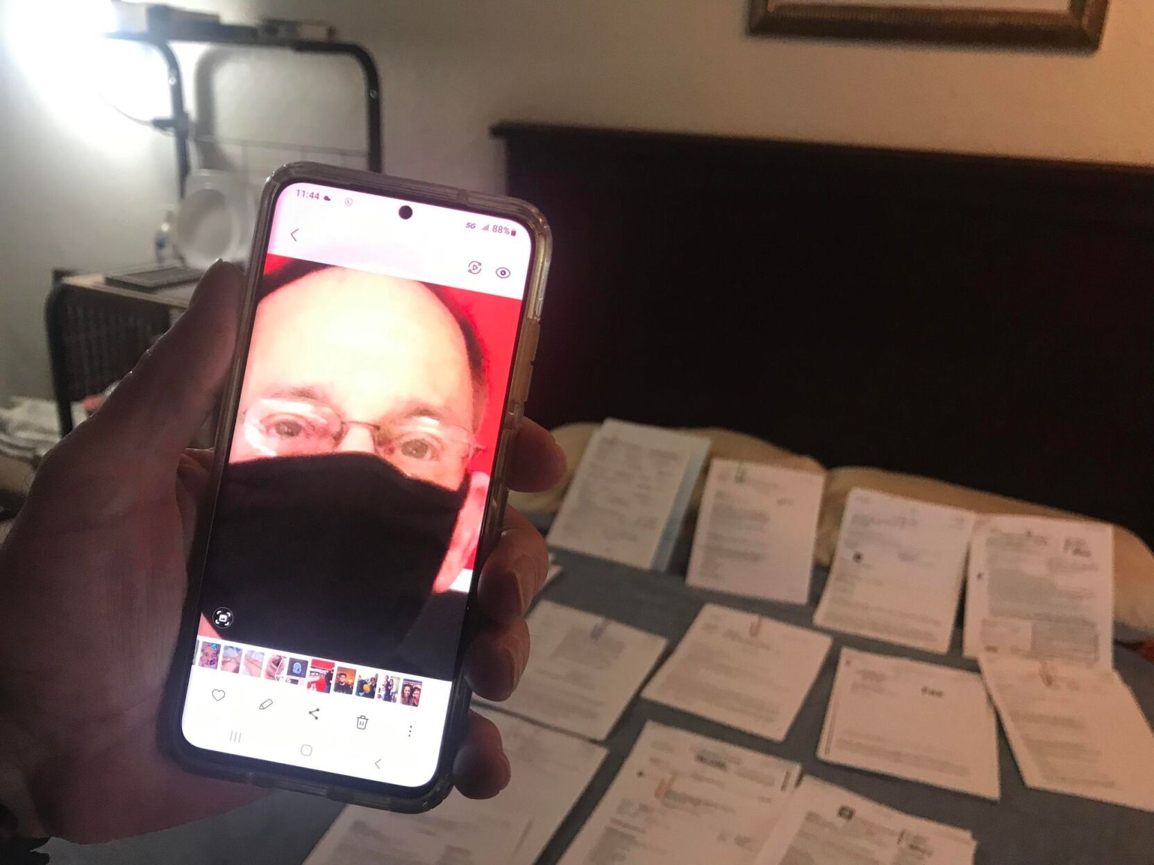 Cancer survivor wakes up from surgery without his right eye and confused by multiple scars